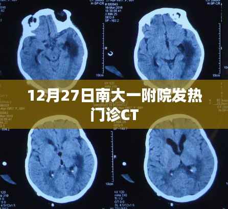 南大一附院发热门诊CT情况报道